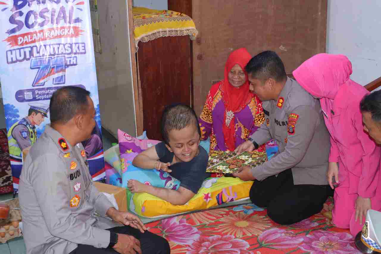 Kapolres Pematangsiantar Kunjungi Anak Penderita Hidrosefalus, Serahkan Bantuan dalam Rangka HUT Lalu Lintas Bhayangkara ke-71